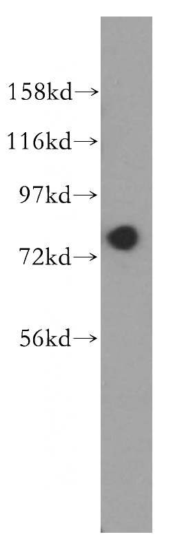 mouse testis tissue were subjected to SDS PAGE followed by western blot with Catalog No:111244(GTPBP4 antibody) at dilution of 1:800