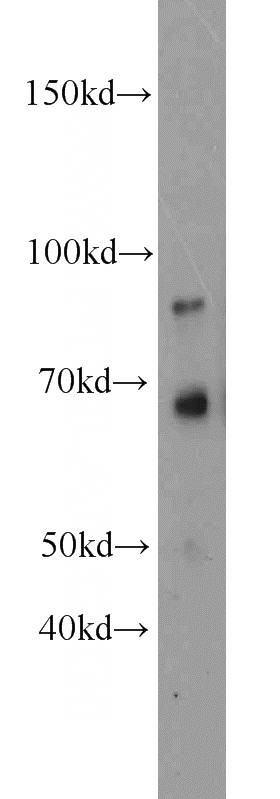 mouse liver tissue were subjected to SDS PAGE followed by western blot with Catalog No:112069(KIRREL2 antibody) at dilution of 1:300