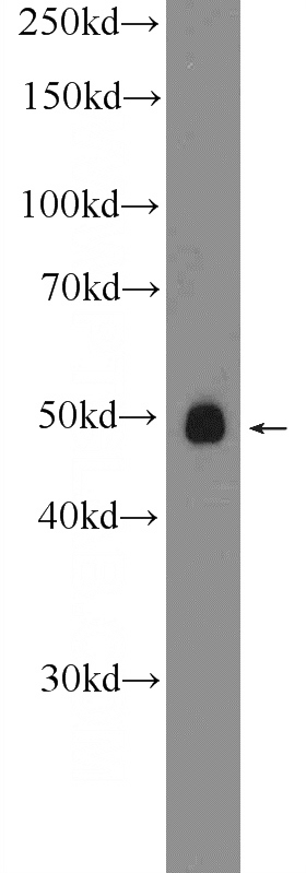 SH-SY5Y cells were subjected to SDS PAGE followed by western blot with Catalog No:114745(RNF167 Antibody) at dilution of 1:300