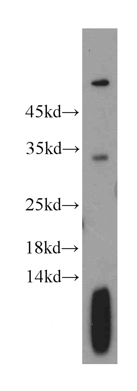 mouse skeletal muscle tissue were subjected to SDS PAGE followed by western blot with Catalog No:116267(TPM2 antibody) at dilution of 1:600