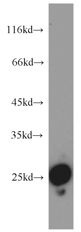 human colon tissue were subjected to SDS PAGE followed by western blot with Catalog No:115559(SPCS2 antibody) at dilution of 1:1200