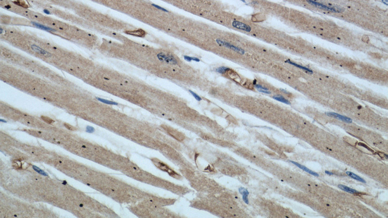 Immunohistochemical of paraffin-embedded human heart using Catalog No:113001(MYPT1 antibody) at dilution of 1:50 (under 40x lens)