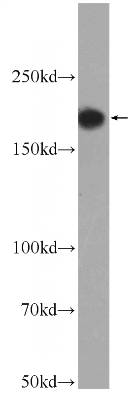 mouse heart tissue were subjected to SDS PAGE followed by western blot with Catalog No:107735(ACE Antibody) at dilution of 1:1000