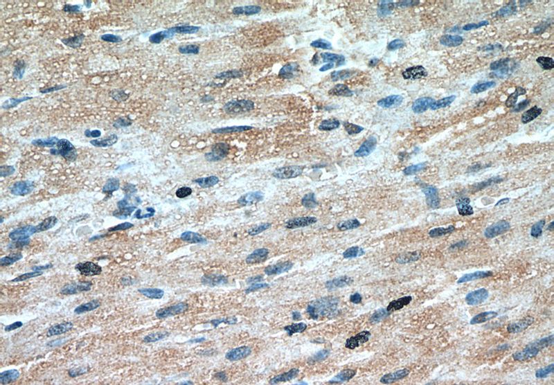 Immunohistochemical of paraffin-embedded human heart using Catalog No:108860(TNNT2 antibody) at dilution of 1:50 (under 40x lens)