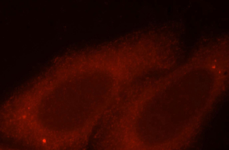 Immunofluorescent analysis of HepG2 cells, using UNC45A antibody Catalog No:116613 at 1:25 dilution and Rhodamine-labeled goat anti-rabbit IgG (red).