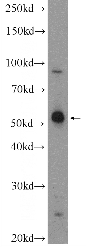 HEK-293 cells were subjected to SDS PAGE followed by western blot with Catalog No:112467(MANEA Antibody) at dilution of 1:300