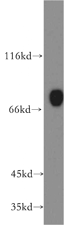 K-562 cells were subjected to SDS PAGE followed by western blot with Catalog No:109150(CD97 antibody) at dilution of 1:300