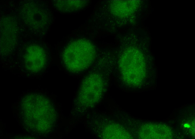 Immunofluorescent analysis of HepG2 cells using Catalog No:115468(SNW1 Antibody) at dilution of 1:25 and Alexa Fluor 488-congugated AffiniPure Goat Anti-Rabbit IgG(H+L)