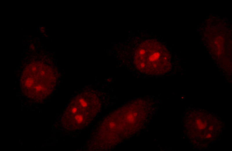 Immunofluorescent analysis of HepG2 cells using Catalog No:109117(CDCA7 Antibody) at dilution of 1:25 and Rhodamine-Goat anti-Rabbit IgG