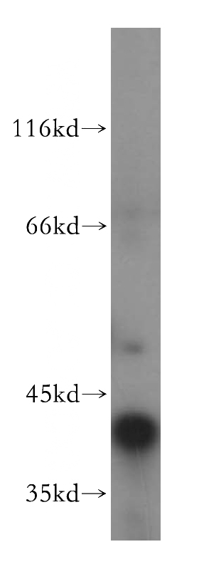 mouse testis tissue were subjected to SDS PAGE followed by western blot with Catalog No:108303(ATP6V0D1 antibody) at dilution of 1:800