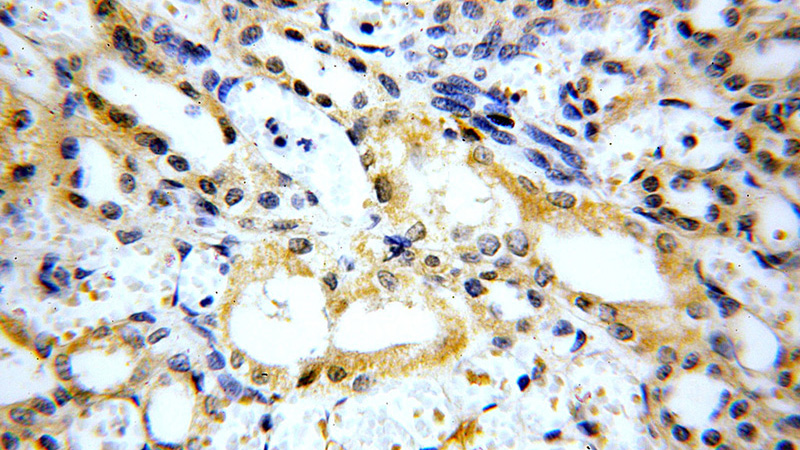 Immunohistochemical of paraffin-embedded human kidney using Catalog No:112481(MARK4 antibody) at dilution of 1:50 (under 40x lens)