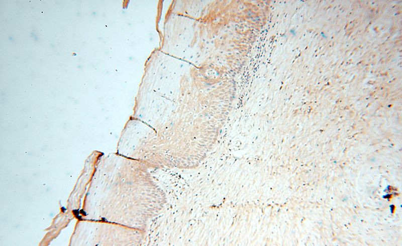 Immunohistochemical of paraffin-embedded human cervix using Catalog No:114976(SAT2 antibody) at dilution of 1:50 (under 10x lens)