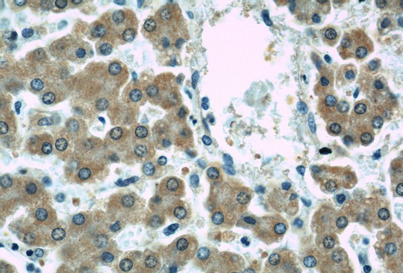 Immunohistochemical of paraffin-embedded human liver using Catalog No:107054(AGT antibody) at dilution of 1:50 (under 40x lens)