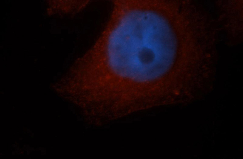 Immunofluorescent analysis of MCF-7 cells, using PDLIM1 antibody Catalog No:113629 at 1:50 dilution and Rhodamine-labeled goat anti-rabbit IgG (red). Blue pseudocolor = DAPI (fluorescent DNA dye).