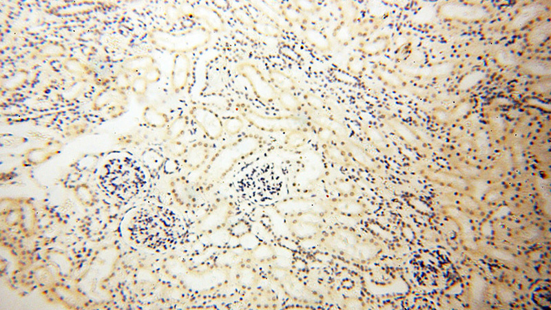 Immunohistochemical of paraffin-embedded human kidney using Catalog No:115432(SMARCC1 antibody) at dilution of 1:100 (under 10x lens)