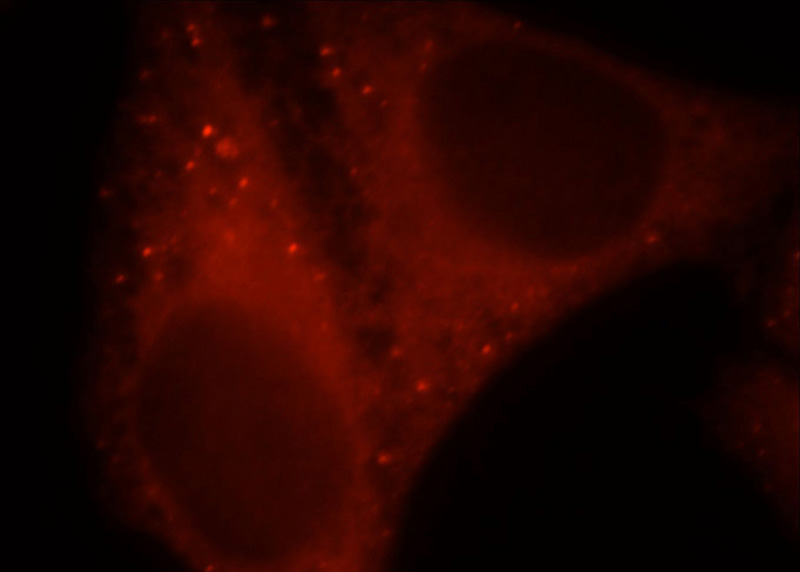 Immunofluorescent analysis of HepG2 cells, using CHKA antibody Catalog No:109241 at 1:25 dilution and Rhodamine-labeled goat anti-rabbit IgG (red).