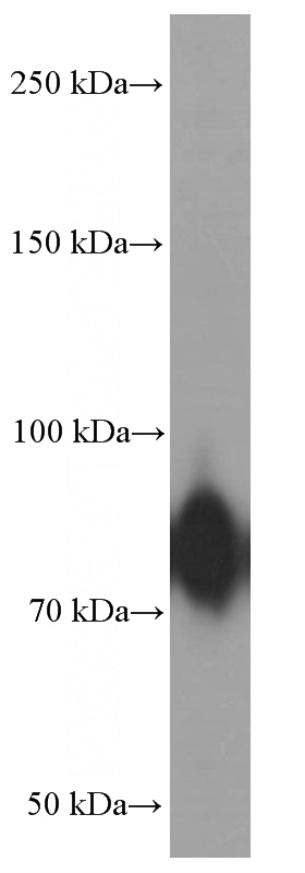 human placenta tissue were subjected to SDS PAGE followed by western blot with Catalog No:107200 (Factor XIIIA Antibody) at dilution of 1:4000