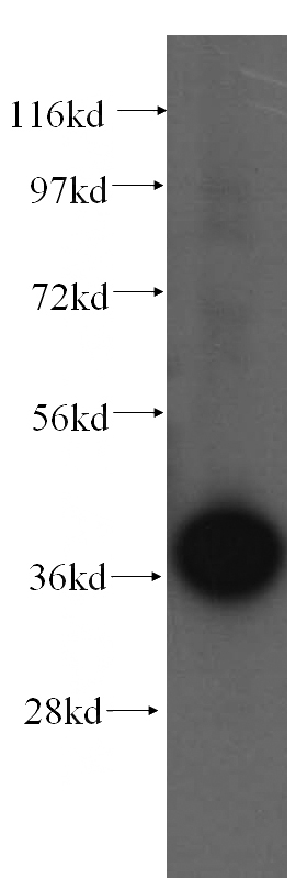 HeLa cells were subjected to SDS PAGE followed by western blot with Catalog No:115500(SORD antibody) at dilution of 1:500