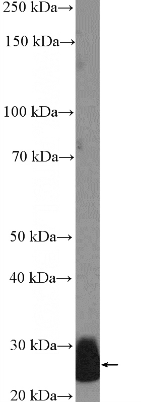 human plasma tissue were subjected to SDS PAGE followed by western blot with Catalog No:109197(CFD Antibody) at dilution of 1:600