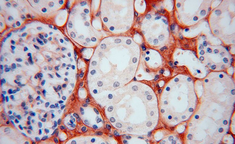 Immunohistochemical of paraffin-embedded human kidney using Catalog No:109438(COL6A1 antibody) at dilution of 1:100 (under 40x lens)