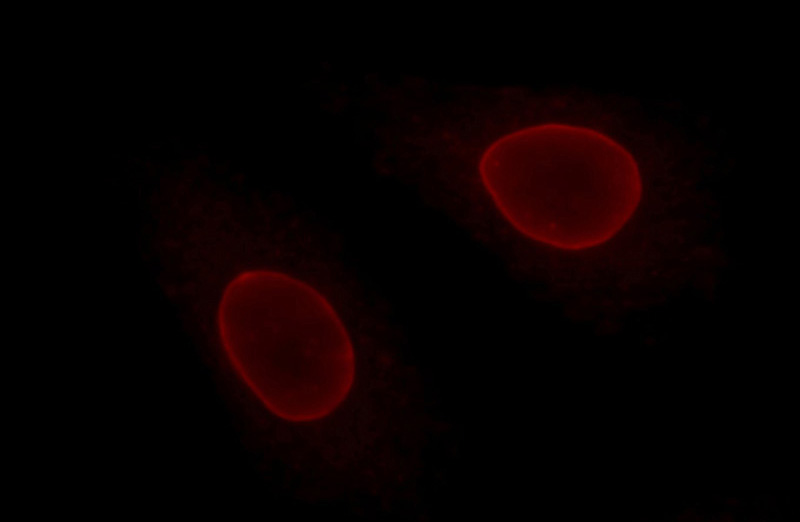 Immunofluorescent analysis of HepG2 cells using Catalog No:117328(Lamin B1 Antibody) at dilution of 1:50 and Rhodamine-Goat anti-Mouse IgG