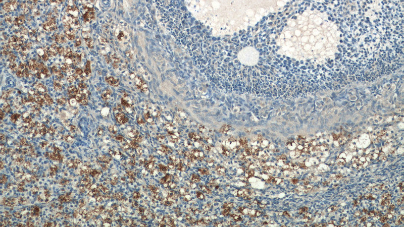 Immunohistochemistry of paraffin-embedded human ovary tissue slide using Catalog No:113930(PLAC1L Antibody) at dilution of 1:50 (under 10x lens)