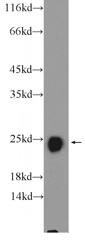 mouse skeletal muscle tissue were subjected to SDS PAGE followed by western blot with Catalog No:116152(TNNI2 Antibody) at dilution of 1:1000