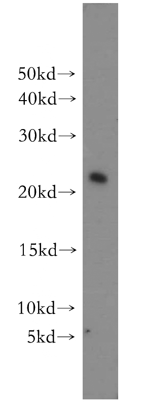 HeLa cells were subjected to SDS PAGE followed by western blot with Catalog No:116527(UBE2H antibody) at dilution of 1:500