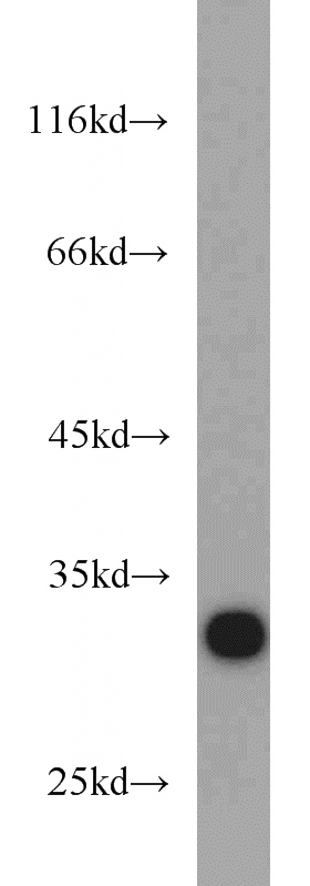 K-562 cells were subjected to SDS PAGE followed by western blot with Catalog No:109158(CDK2 antibody) at dilution of 1:600