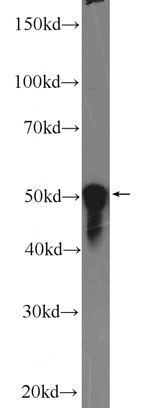 Jurkat cells were subjected to SDS PAGE followed by western blot with Catalog No:116039(THAP11 Antibody) at dilution of 1:1000