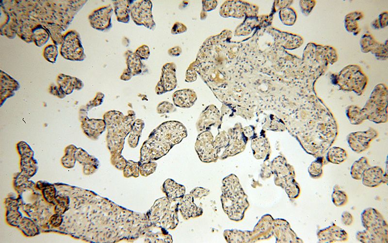 Immunohistochemical of paraffin-embedded human placenta using Catalog No:108836(CAPN6 antibody) at dilution of 1:50 (under 10x lens)