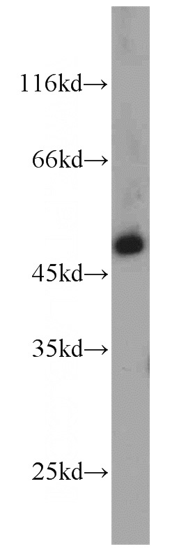mouse retina tissue were subjected to SDS PAGE followed by western blot with Catalog No:111670(IFT57 antibody) at dilution of 1:1000
