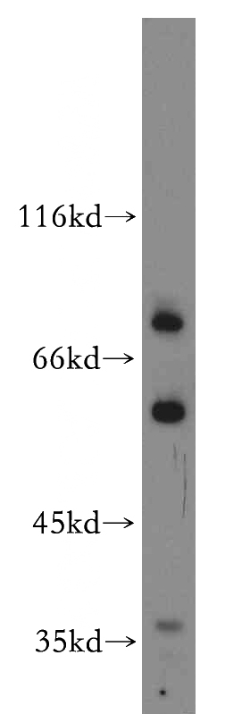 A431 cells were subjected to SDS PAGE followed by western blot with Catalog No:115275(SHKBP1 antibody) at dilution of 1:300