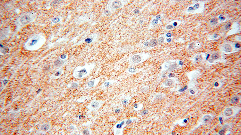 Immunohistochemical of paraffin-embedded human brain using Catalog No:117256(SLC30A3 antibody) at dilution of 1:100 (under 40x lens)