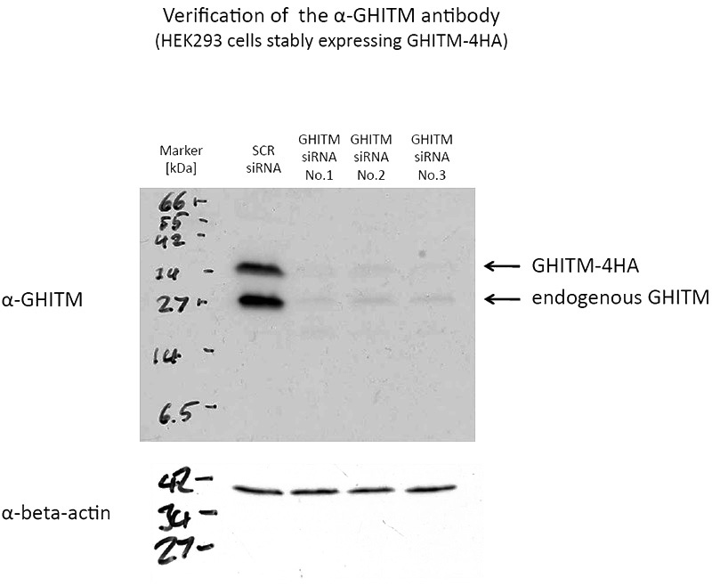 WB results of GHITM antibody (Catalog No:110965) with siRNA sample.