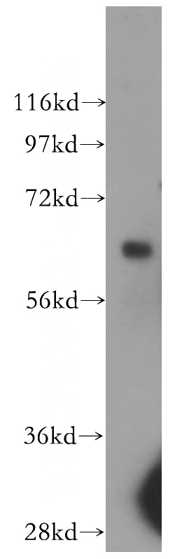 human placenta tissue were subjected to SDS PAGE followed by western blot with Catalog No:108208(ARSD antibody) at dilution of 1:500