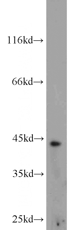 mouse liver tissue were subjected to SDS PAGE followed by western blot with Catalog No:117221(Brachyury-T antibody) at dilution of 1:500