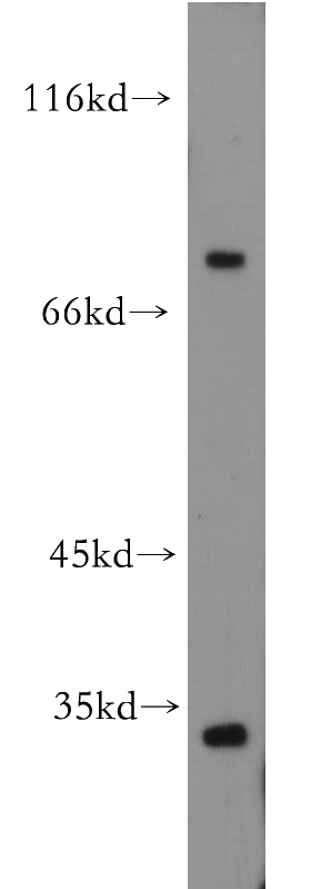 mouse brain tissue were subjected to SDS PAGE followed by western blot with Catalog No:115345(SLC5A3 antibody) at dilution of 1:300