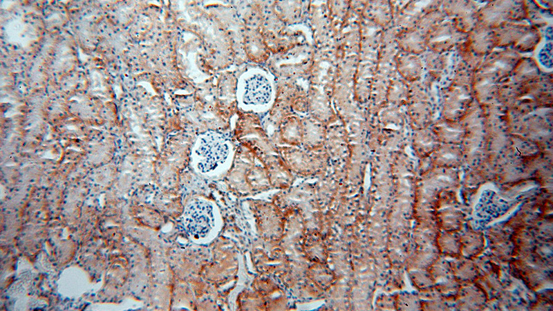 Immunohistochemical of paraffin-embedded human kidney using Catalog No:108744(CA12 antibody) at dilution of 1:50 (under 10x lens)