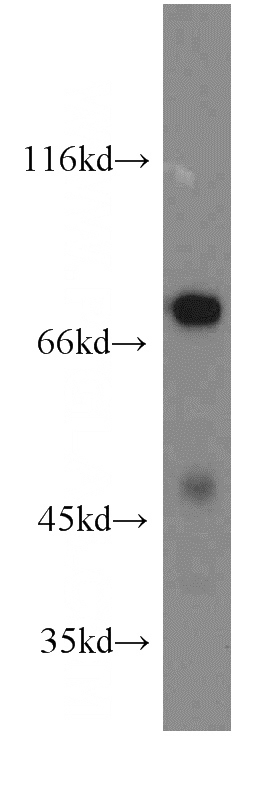mouse heart tissue were subjected to SDS PAGE followed by western blot with Catalog No:111875(IVNS1ABP antibody) at dilution of 1:800