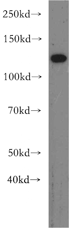 mouse colon tissue were subjected to SDS PAGE followed by western blot with Catalog No:114604(RBM19 antibody) at dilution of 1:300