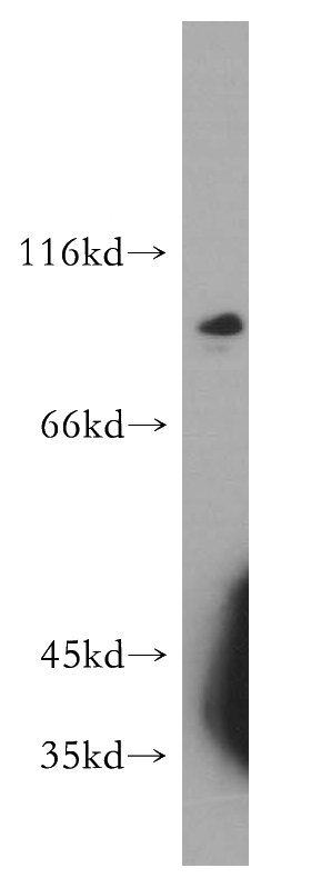 mouse cerebellum tissue were subjected to SDS PAGE followed by western blot with Catalog No:115575(SPIRE2 antibody) at dilution of 1:500
