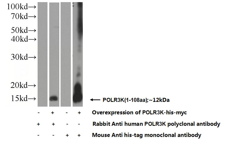 Transfected HEK-293 cells were subjected to SDS PAGE followed by western blot with Catalog No:114054(POLR3K Antibody) at dilution of 1:1000