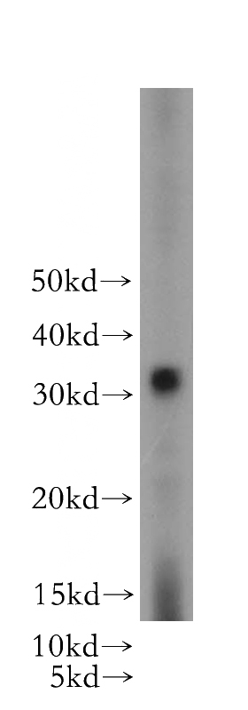 mouse liver tissue were subjected to SDS PAGE followed by western blot with Catalog No:111006(GNMT antibody) at dilution of 1:500