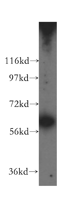 HepG2 cells were subjected to SDS PAGE followed by western blot with Catalog No:109838(DDX52 antibody) at dilution of 1:500