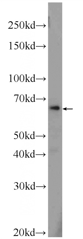 HepG2 cells were subjected to SDS PAGE followed by western blot with Catalog No:117033(ZNF774 Antibody) at dilution of 1:600