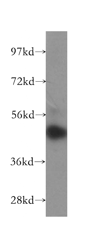 Jurkat cells were subjected to SDS PAGE followed by western blot with Catalog No:109602(CSNK1G1 antibody) at dilution of 1:300