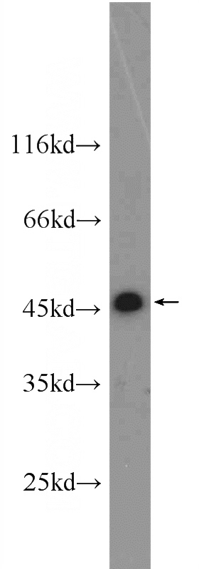 A431 cells were subjected to SDS PAGE followed by western blot with Catalog No:113289(NSFL1C antibody) at dilution of 1:800