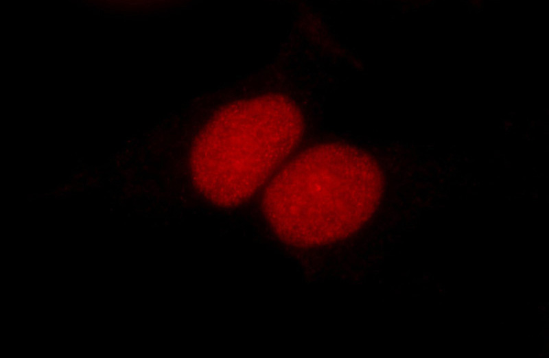 Immunofluorescent analysis of HepG2 cells using Catalog No:107238(DEK Antibody) at dilution of 1:50 and Rhodamine-Goat anti-Mouse IgG