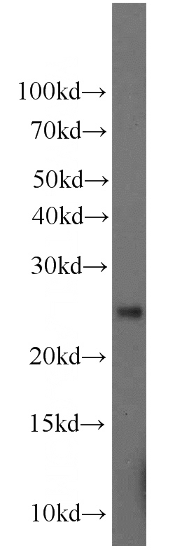 A375 cells were subjected to SDS PAGE followed by western blot with Catalog No:107883(GFER antibody) at dilution of 1:1000